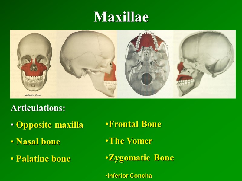 Maxillae   Articulations:  Opposite maxilla  Nasal bone  Palatine bone Frontal